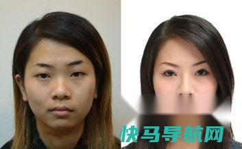 肤色不均？ 第3张